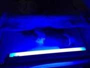 Лампа для лечения желтушки новорожденных 
